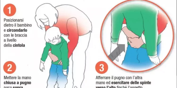 Manovra di Heimlich: come si fa e perché può salvare la vita