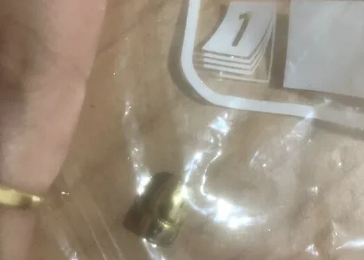 Napoli: proiettile vagante finisce in testa a un bambino. Indagano i carabinieri