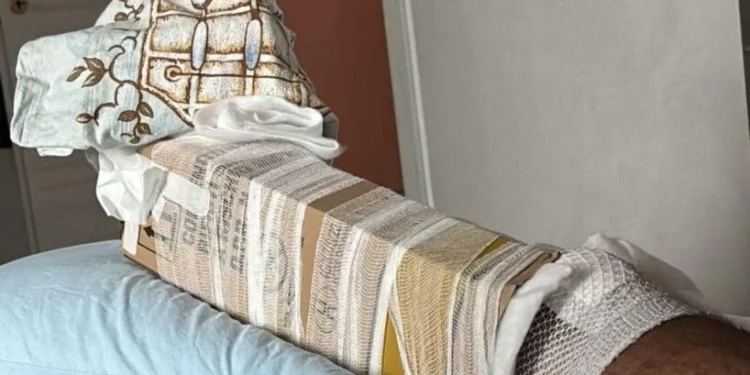 Lo scandalo del cartone al posto del gesso per bloccare gamba fratturata, rimosso il capo del pronto soccorso