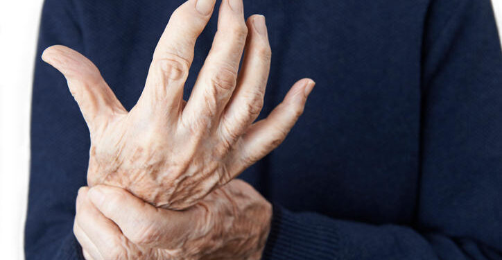 Parkinson, in 60 giorni via ai trattamenti per cancellare il tremore: all’A.O.U. Luigi Vanvitelli nuova tecnologia