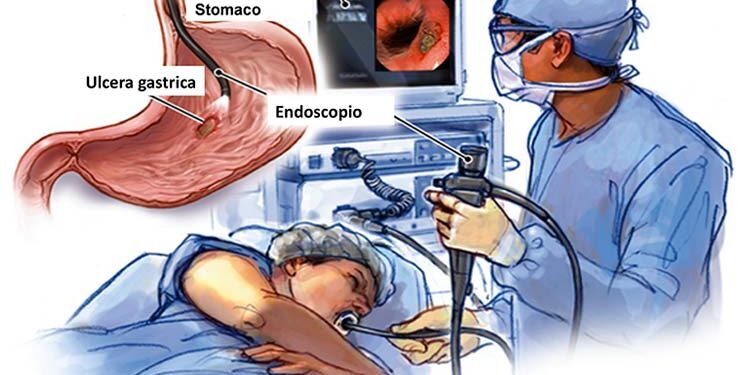 Chirurgia dell’apparato digerente endoscopia digestiva, tutte le informazioni utili