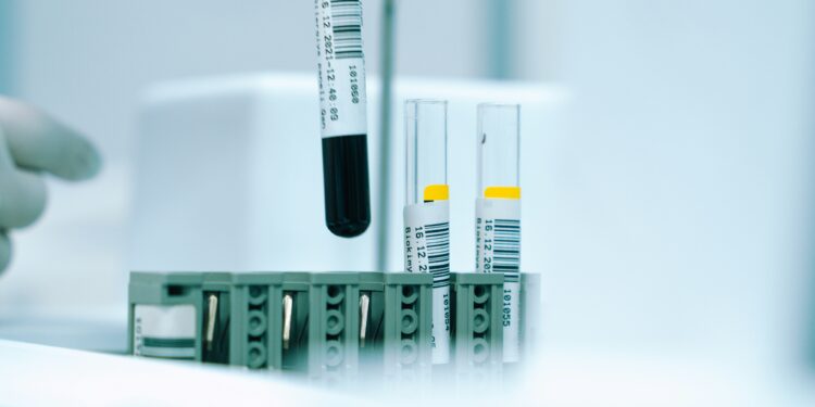Cosa evitare a cena prima delle analisi del sangue: guida pratica per risultati affidabili
