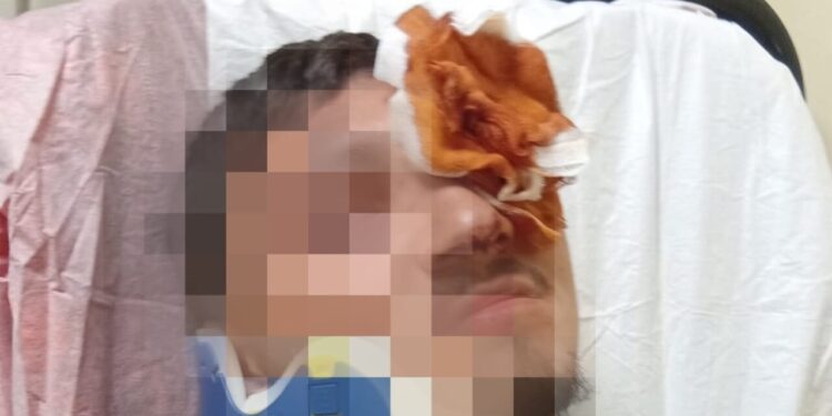 Portici, 16enne disabile massacrato per un saluto a una ragazza