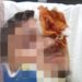 Portici, 16enne disabile massacrato per un saluto a una ragazza