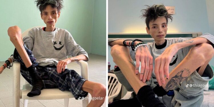 È morto Thiago Elar, tiktoker bergamasco: la voce di una generazione silenziosa si è spenta a 27 anni