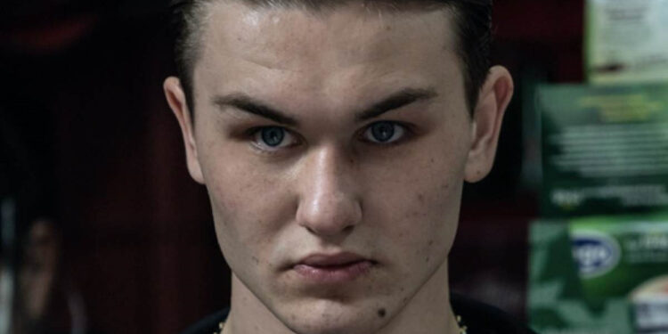 Aggressione al pronto soccorso: denunciato l’attore di Mare Fuori