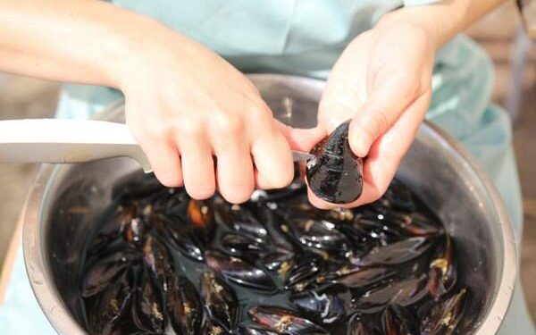 Epatite A a Napoli, casi sotto controllo: nessun allarme sanitario, chiarimenti degli infettivologi