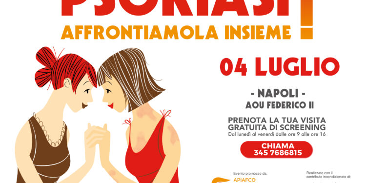 Psoriasi, consulti dermatologici gratuiti alla Federico II di Napoli: il 4 luglio una giornata dedicata ai pazienti