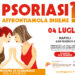 Psoriasi, consulti dermatologici gratuiti alla Federico II di Napoli: il 4 luglio una giornata dedicata ai pazienti