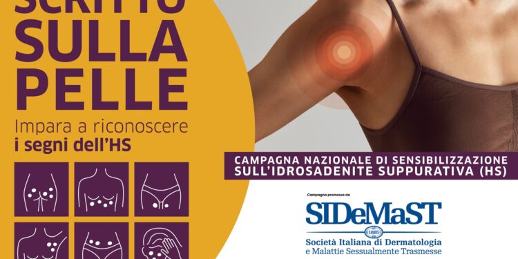 A Napoli consulti dermatologici gratuiti con la campagna “Scritto sulla pelle”